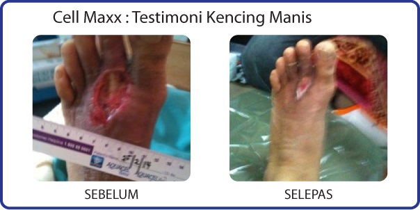 Image result for testimoni cellmax